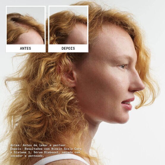 Kit Sistema 1 Espessamento para Cabelos Naturais Nioxin
